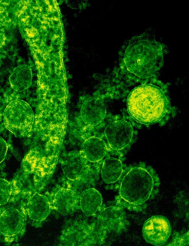 Microscopic view of a virus
